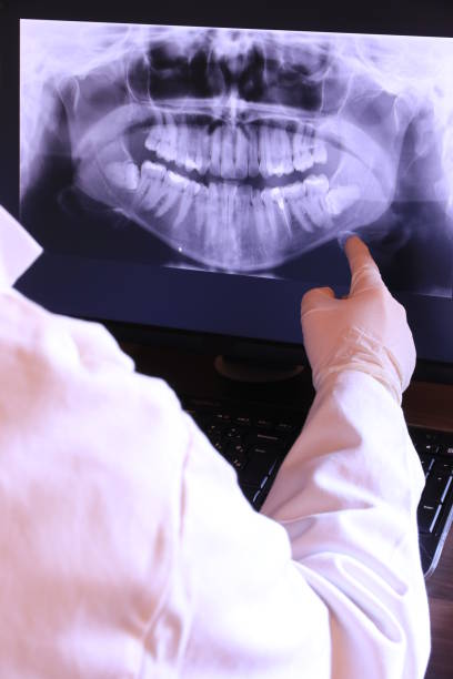 Best Emergency Dental Filling Replacement  in Rib Mountain, WI